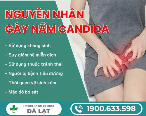 Hình ảnh minh họa